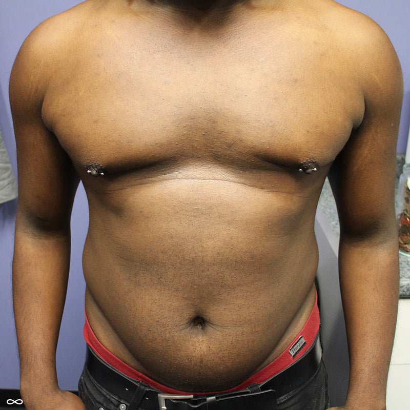 Nipple piercings by John