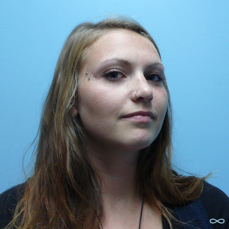 Surface anchors by Kellan